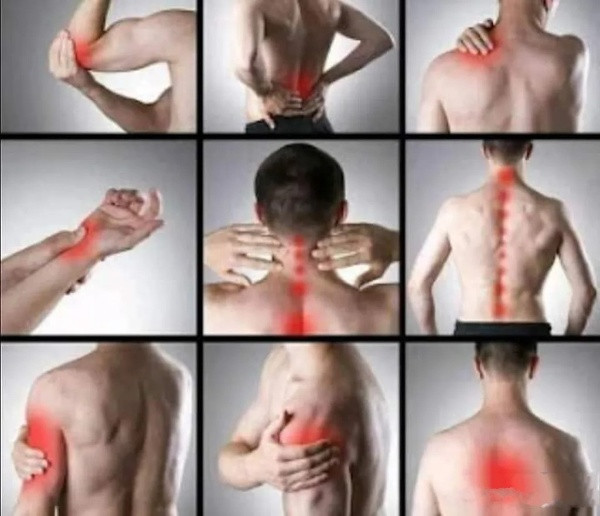 العلاج بالحجامة